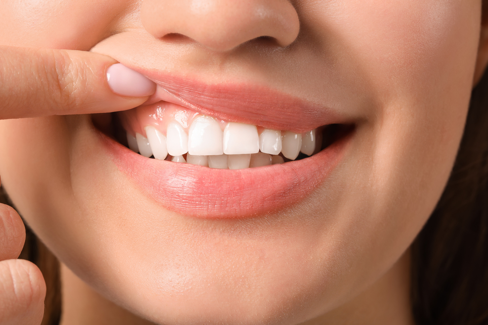 gum disease treatment