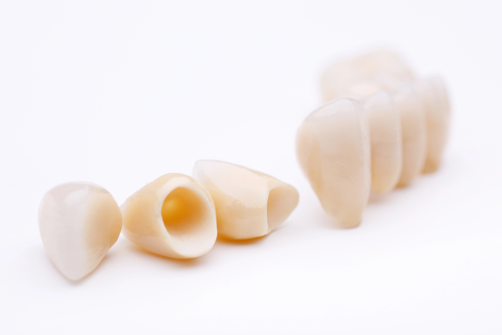 Dental crowns
