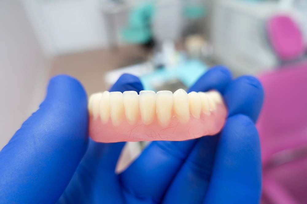 overdenture technology