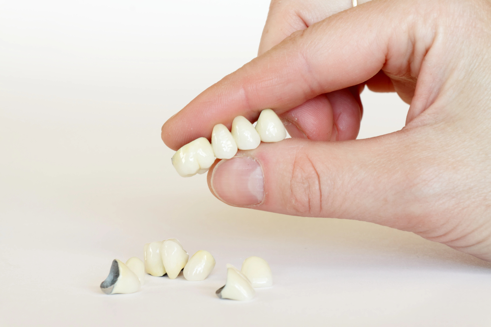 dental crowns