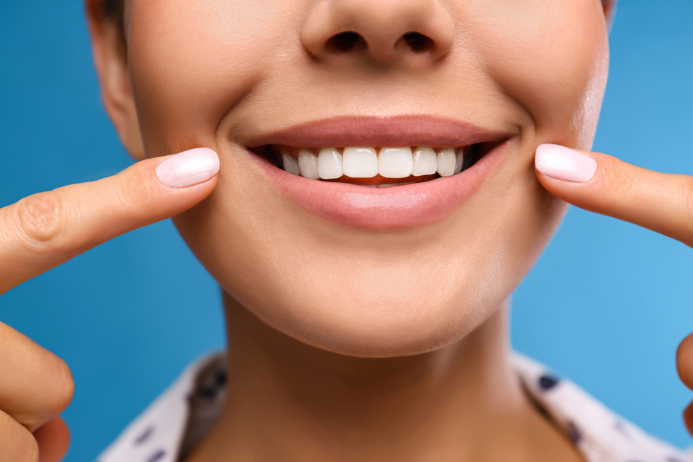 smile makeover